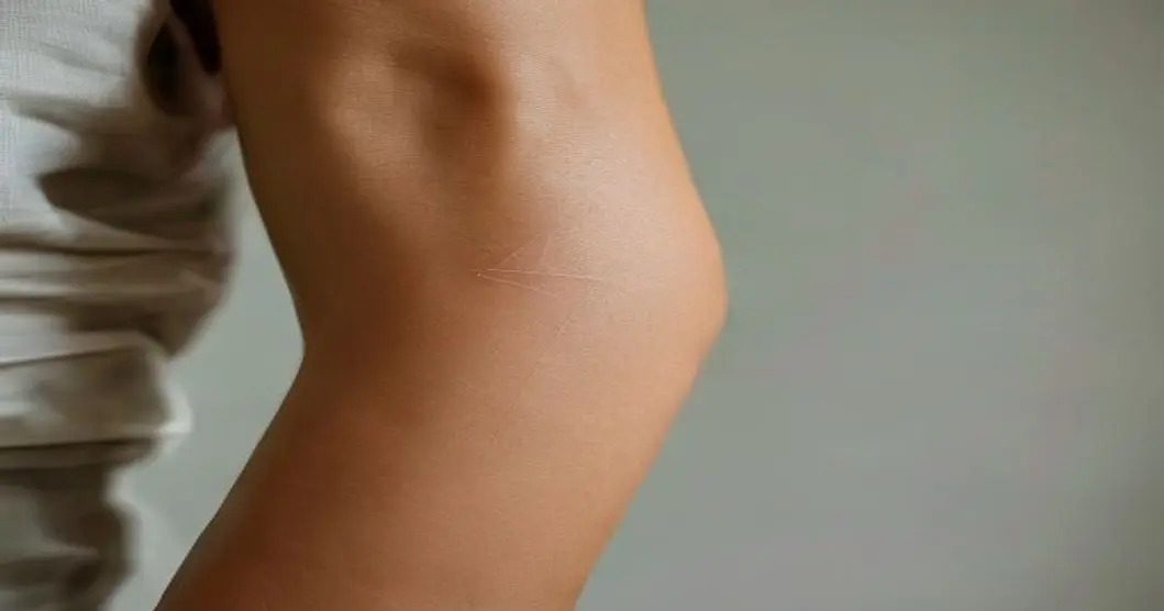 Implantes estéticos: lo que debes saber antes de modificar tu cuerpo 7 Close-up photograph of a person's forearm showing a subtle geometric subdermal implant under the skin, with soft shadows and a clean, minimalist studio background, no text.